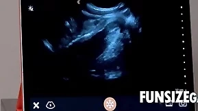 Ultra seemly penetration check up on - dr wolf, austin