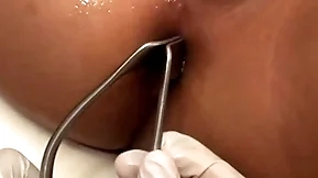 Asian patient penetrated in anal hole unconnected with pencil in parson