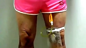 Catheter upon collecting sac hard by pinky 396